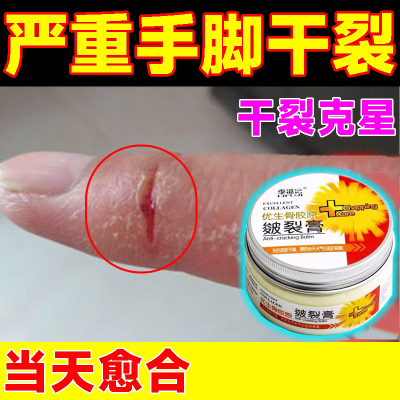 专治手裂的药膏防皲裂手脚干裂手指开裂口脱皮干燥粗糙专用防裂膏