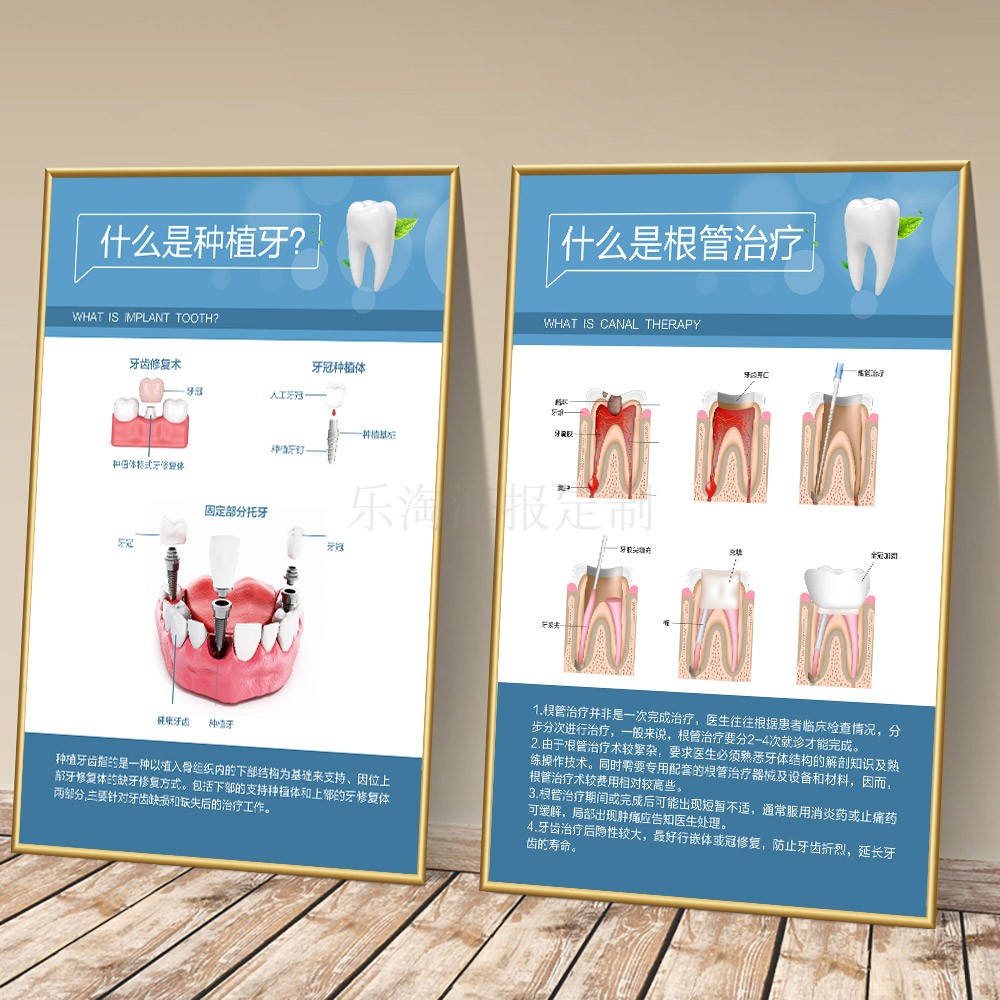 牙科诊所种植牙铝合金装饰画根管治疗宣传海报定制画KT板口腔医院