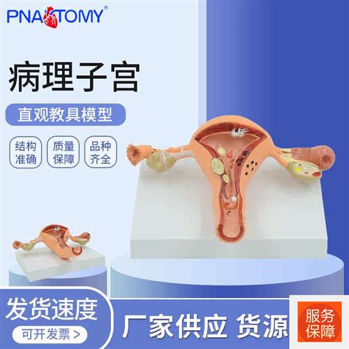 病理子宫模型f教具人体卵巢解剖女性生G殖科展示阴道妇科解剖教学