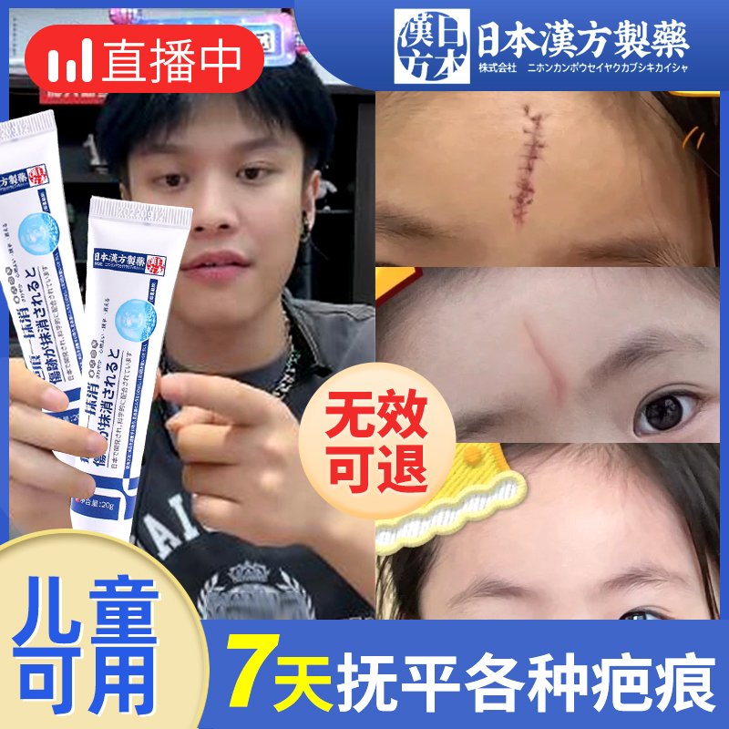 去祛疤膏儿童专用小孩疤痕修复除疤日本去黑印烫伤去疤膏官方正品
