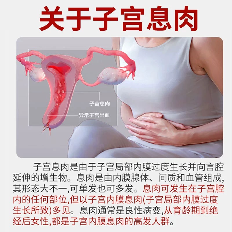 速发自动脱落】子宫内膜息肉药子宫肌瘤中药贴子宫下垂宫颈纳囊肥