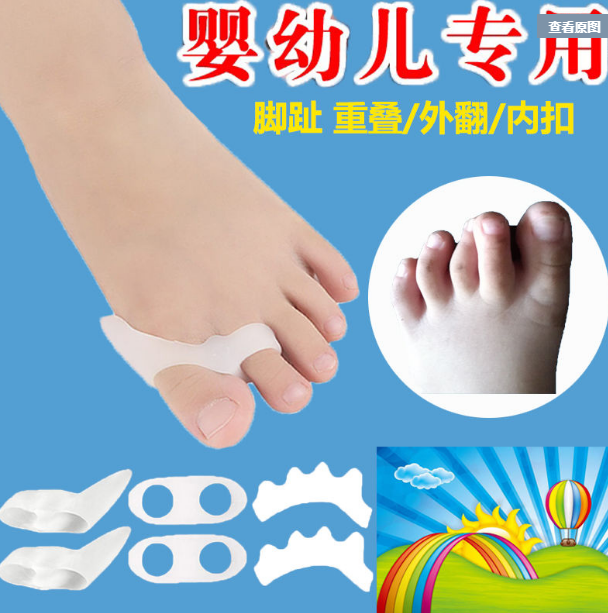 婴幼儿脚趾矫正器儿童脚拇指外翻矫正器重叠趾分趾器分离器可穿鞋